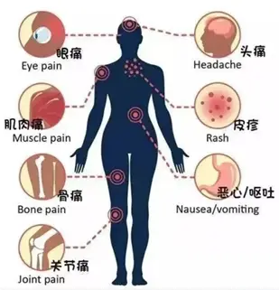 Infographic showing common symptoms of dengue