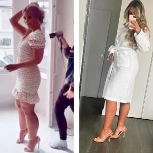 Shaughna shared the before and after photos of her leg surgery