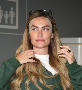 Woman with bandages on her face after surgery.
