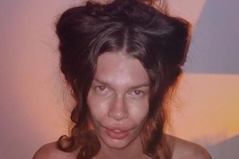 I spent £6k on surgery to look like a CAT & regret it – I’m in agony & it stops from me being able to speak properly