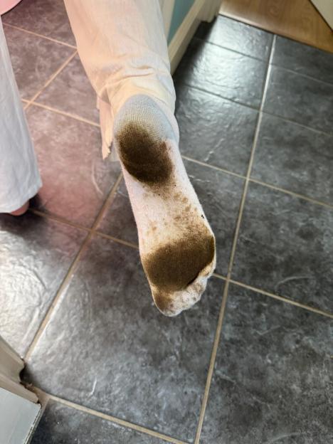 Mud-covered sock.
