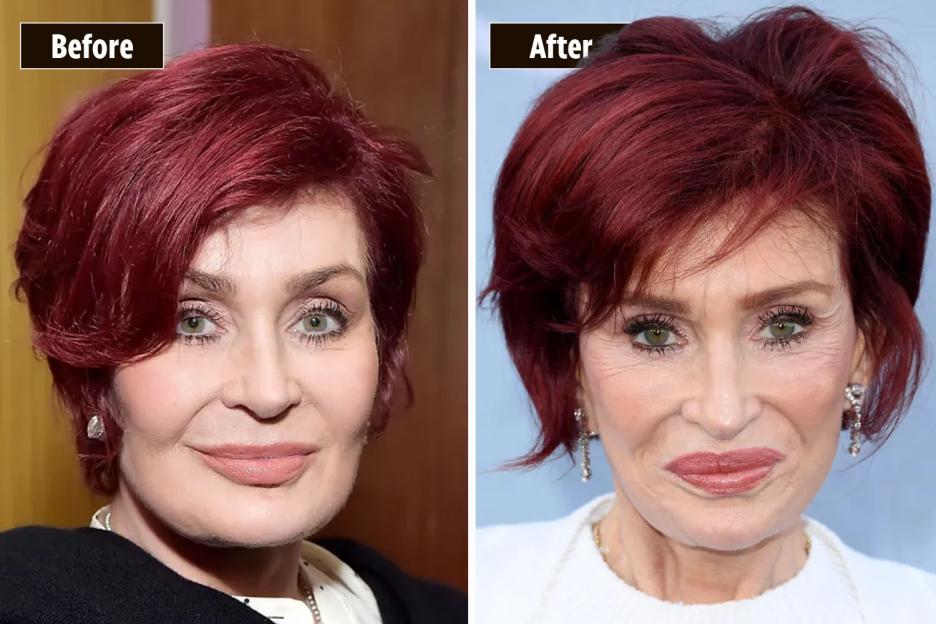 Before and after photos of Sharon Osbourne's haircut.