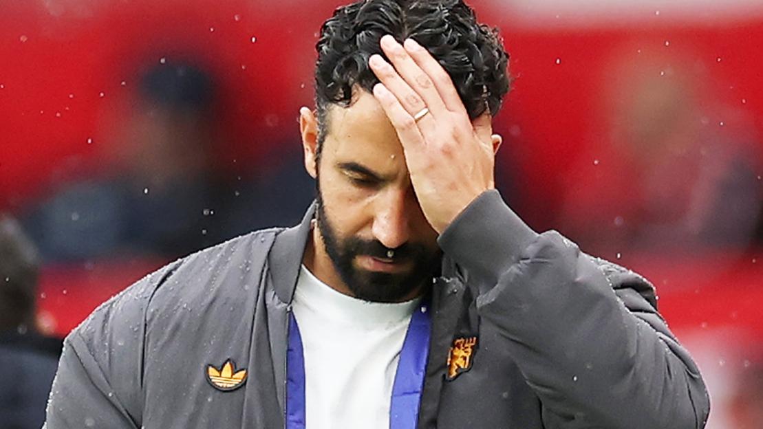 Ruben Amorim looking distraught.