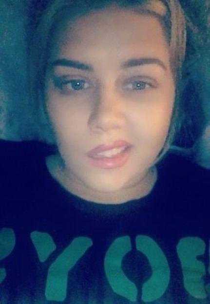 Photo of Amber, who was diagnosed with mumps and Bell's palsy in 2018.