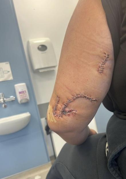 Brit teen was ‘stabbed with broken GLASS BOTTLE’ by tourist while walking back to Benidorm hotel after family night out