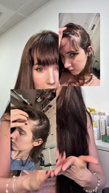 Collage of a woman with bangs and long dark hair, showing pictures of her before and after experiencing hair breakage and balding.