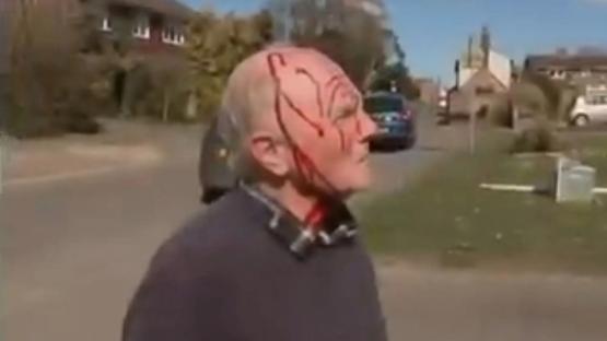 Shock moment man is attacked by dive-bombing HAWK in quiet village leaving him bloodied & in hospital