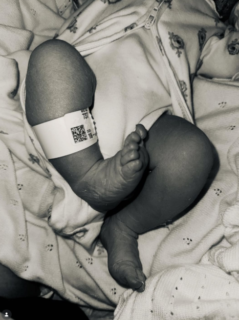 A newborn baby's legs and feet, wearing a hospital identification band on its ankle.