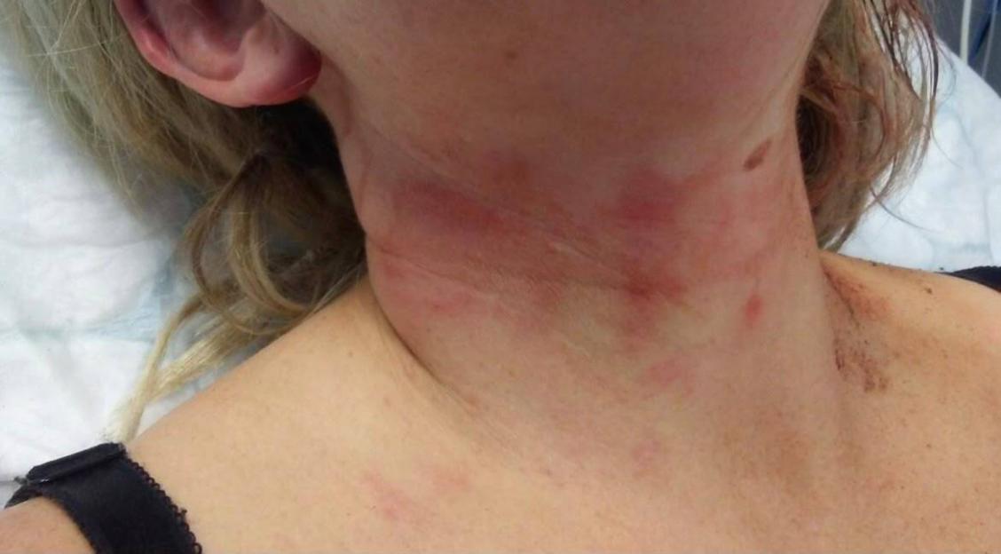 Lucy Winter, a domestic abuse victim.
