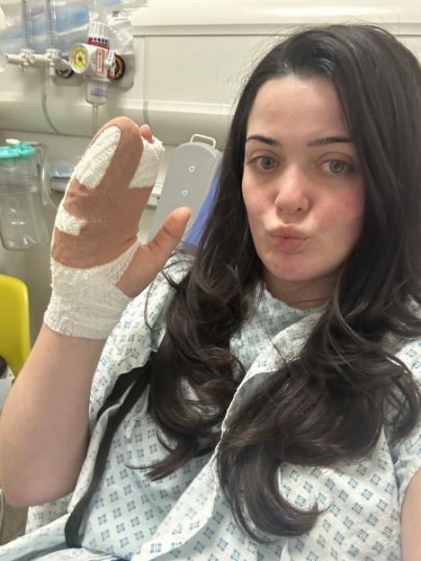 Lucy Crabb's hand with her pinkie finger bandaged after it was chopped off.