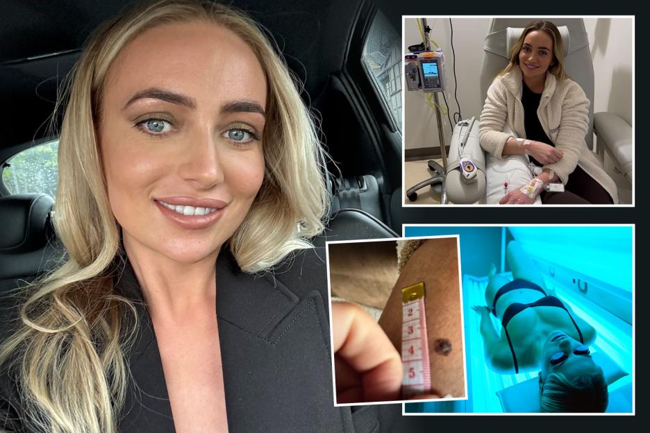From Sun-Kissed Competitions to a Fight for Life: My Journey with Cancer at 30