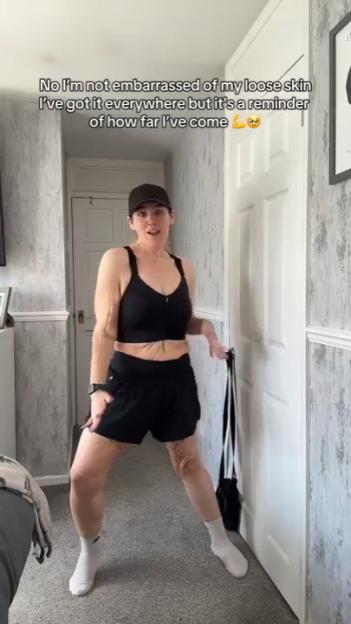 'TikTok Sensation Becki Jones Celebrated by Fans for Embracing Her Journey with Loose Skin Post-Weight Loss'
