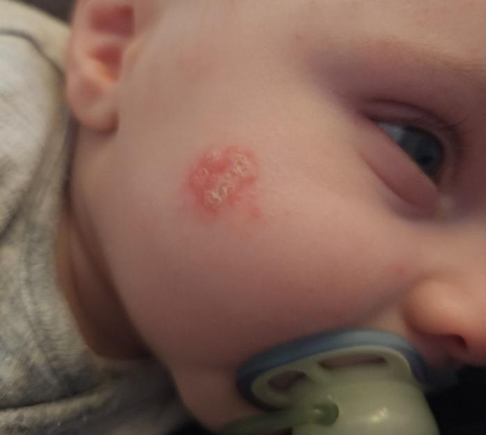 Mum shares warning after Fairy detergent left baby "ripping face off" in irritation