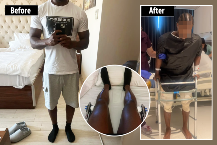 'I Spent £20k to Increase My Height from 5ft 6in—The Pain Was Intense, but I Have No Regrets!'