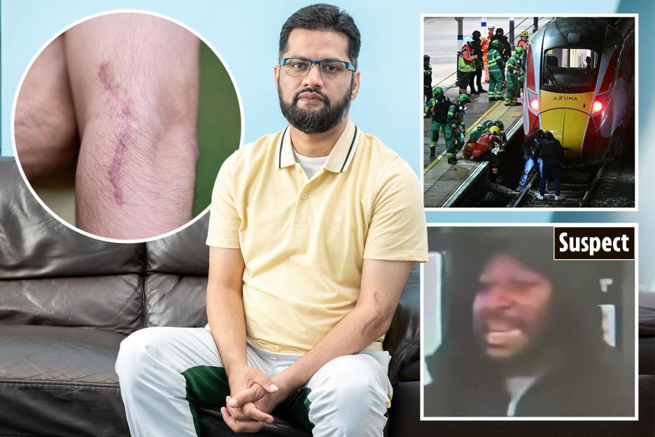 'Confronting a Knifeman in a Huntingdon Train Attack Left Me Paralyzed and Broke – My Life Will Never Be the Same'