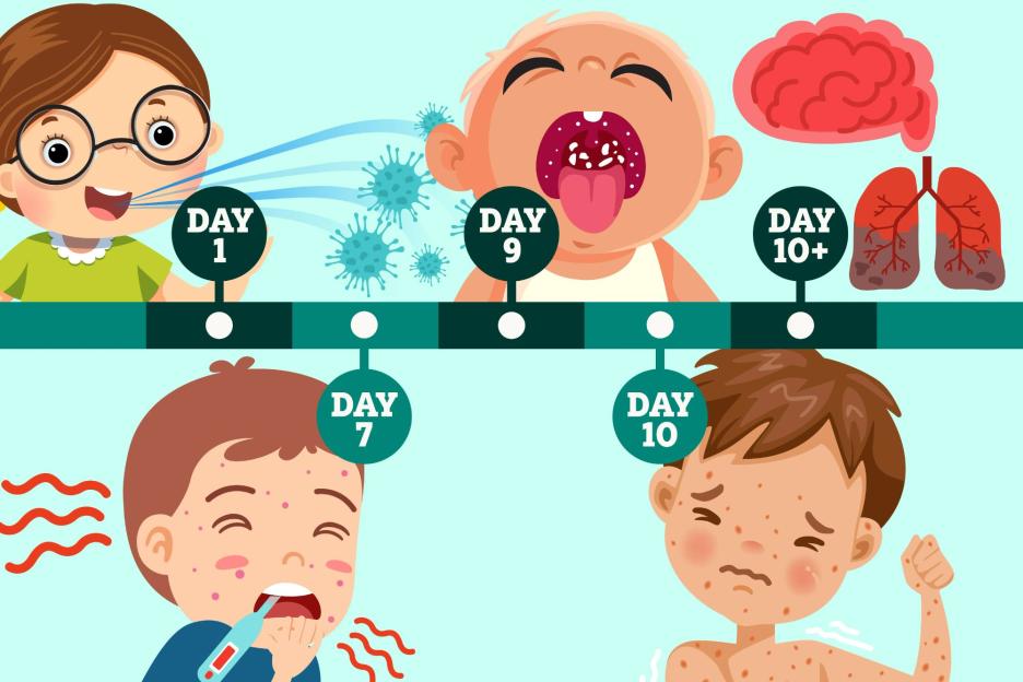 'Unveiling the Symptom Timeline of the 'World's Most Infectious Disease' as Cases Spike, Especially Among Kids Under 5'