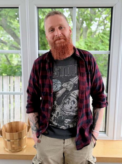 Gavin Sutherland, who suffered serious burns to his leg after a vape battery exploded in his pocket.