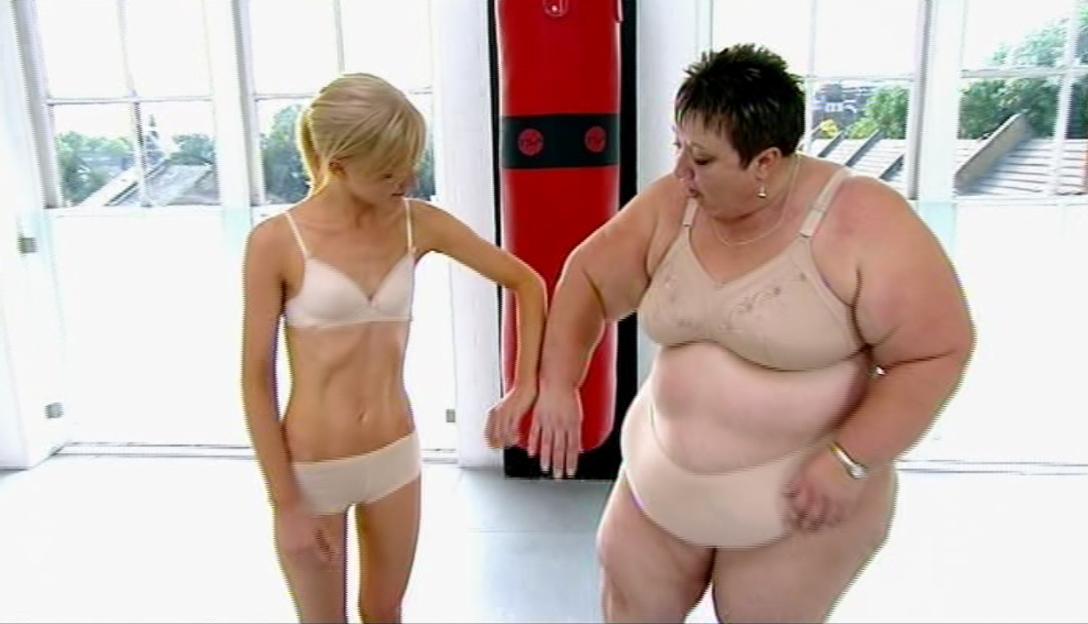 A very thin woman in white underwear touching the arm of a very obese woman in beige underwear.
