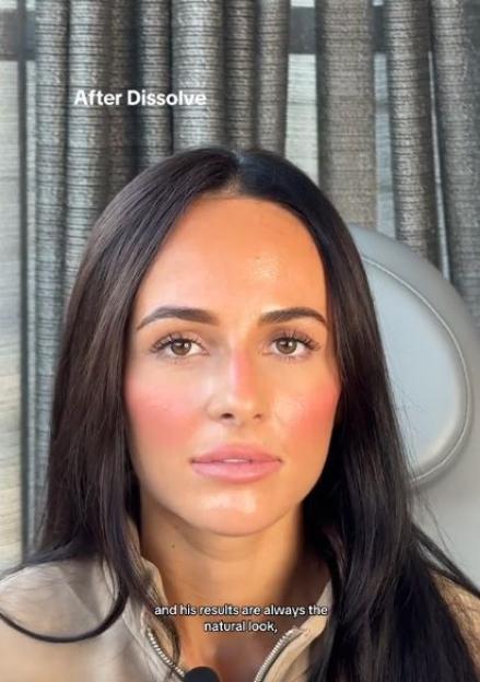 A woman with dark hair and light makeup looking at the camera, with the text "After Dissolve" at the top left.