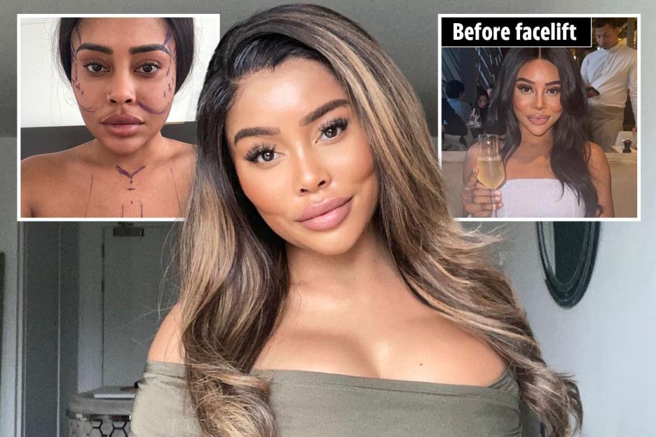 'I Spent £10K on a Facelift at 29 and Now I’m Seeking a £200K Partner – Trolls Can’t Bring Me Down!'