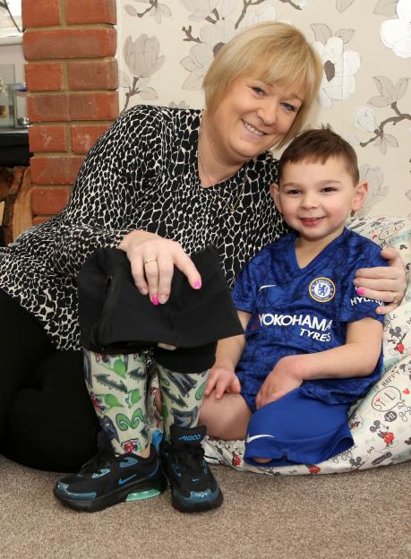 A boy with prosthetic legs sits with his adoptive mother.