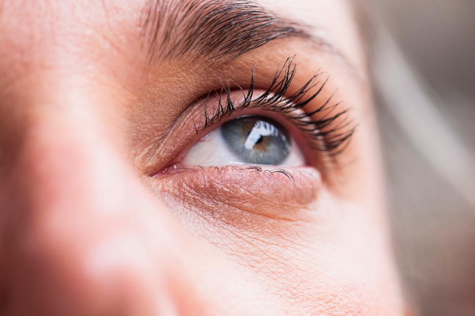 The Small Spot Beneath Your Eye That Could Signal a Stroke Risk Within the Next Decade