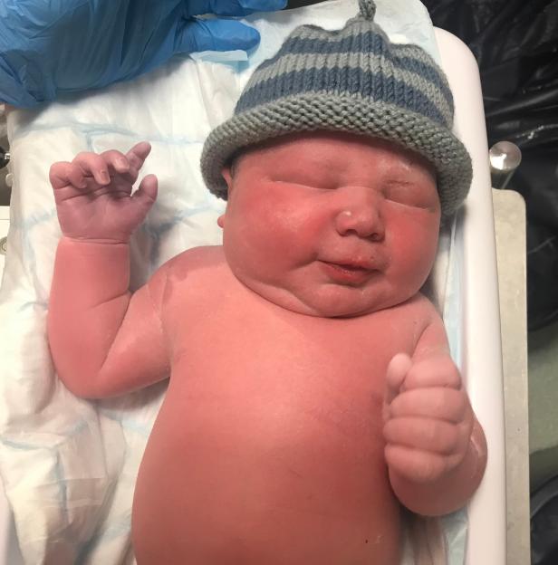 A newborn baby with red skin and a striped knit cap on a white cloth.