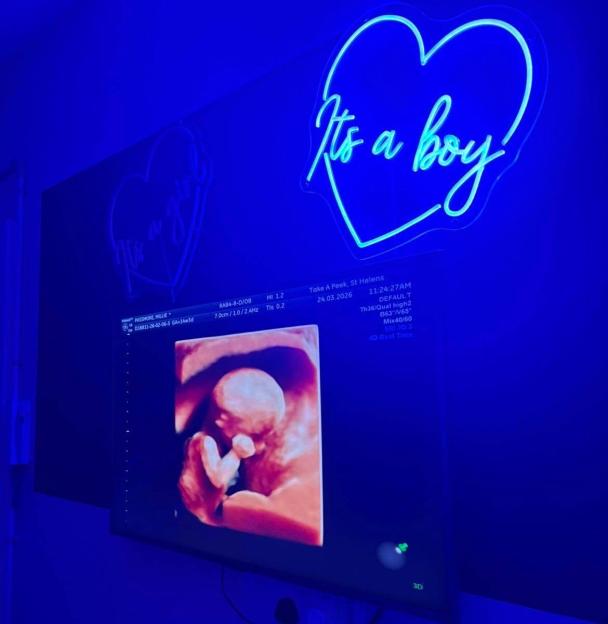 An ultrasound image showing a baby, with a neon "It's a boy" sign in the background.