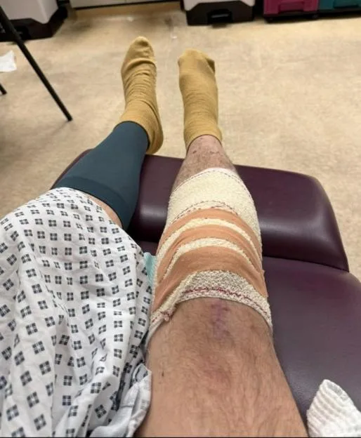 ¿Devastated¿ man learns attacker who nearly killed him could be released early