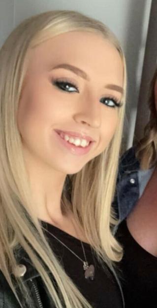 A dog Id known for years ripped my face apart in seconds  I just want to look normal again