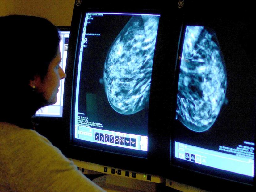 A doctor uses a digital pen to point at a breast scan image displayed on a tablet.
