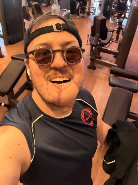Man with reconstructed jaw smiling in a gym.