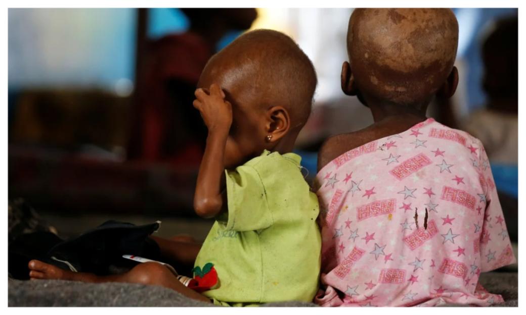 Kebbi's Malnutrition Emergency Escalates: Children at Risk of Life-Threatening Hunger