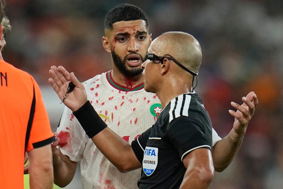 Morocco's Ismael Saibari Left Bloodied and Shirtless After World Cup Showdown with Holland