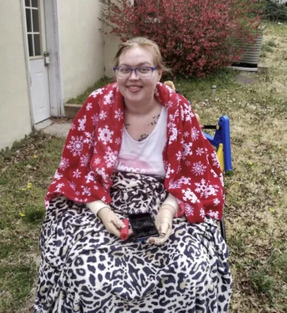 A woman with amputated hands and prosthetic arms smiles at the camera, covered in blankets, sitting in a backyard.