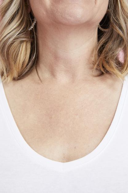 Close-up of a person's décolletage showing fine lines, wearing a white shirt.