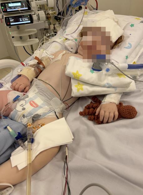 Toddler left fighting for life after inhaling cake decoration powder that ¿turned to paste in his lungs¿
