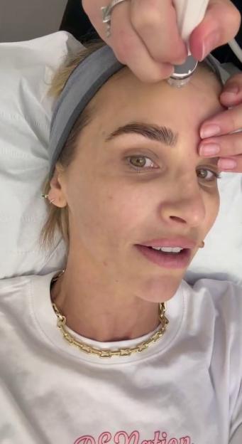 Vogue Williams undergoing a cosmetic treatment on her forehead.