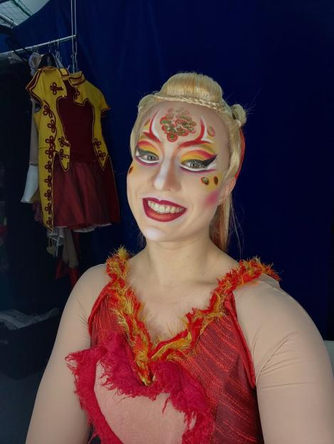 Acrobat Left with Severe Injuries from 15ft Fall Now Files £12m Lawsuit Against Circus