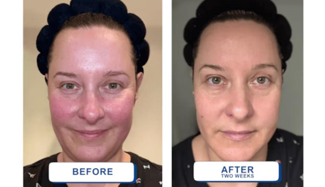 NINTCHDBPICT001055765549