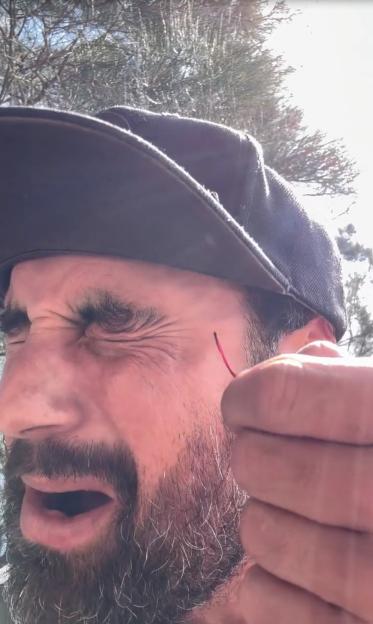 Cam Merchant trying to remove the hook