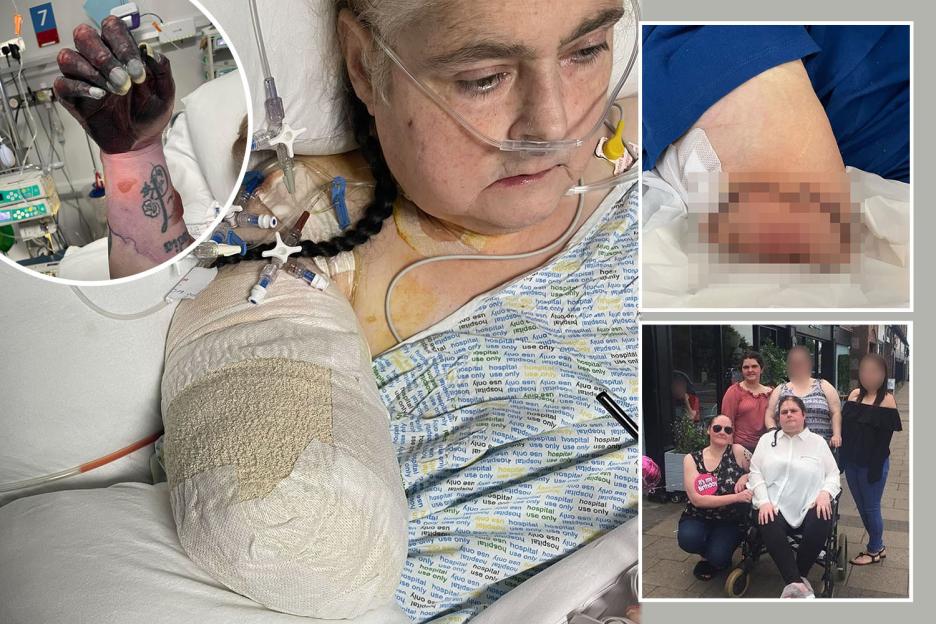 Mum's Finger Blemish Blamed on Newspaper Ink—Just Days Later, Her Arm Was Amputated, and Months After, She Tragically Passed Away