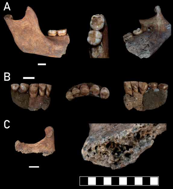 Collage of mandible fragments with molar teeth, showing different views and a cross-section of the bone.