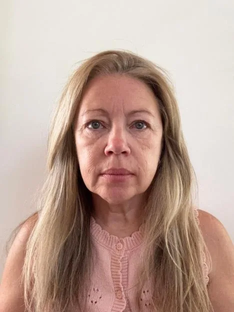 I got a 90p-a-day ‘handbag facelift’… I looked like a different person in 8 weeks & even my teenagers complimented me