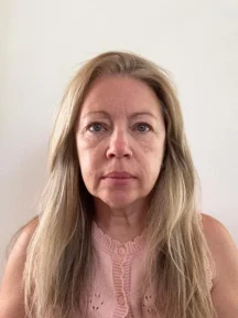 I got a 90p-a-day ‘handbag facelift’… I looked like a different person in 8 weeks & even my teenagers complimented me
