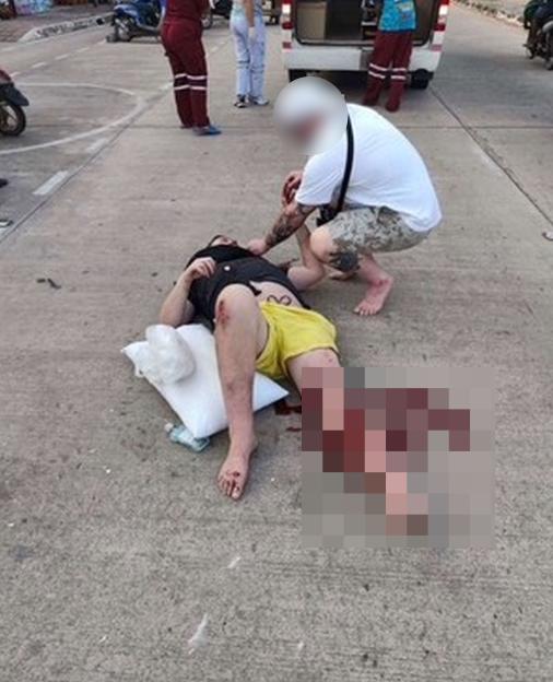 30-Year-Old Brit Faces £20k Hospital Bill After Devastating Moped Crash in Thailand – Urges for Support