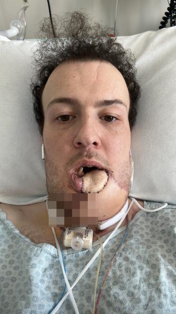Andr? Gayoso in a hospital bed with his jaw reconstructed.