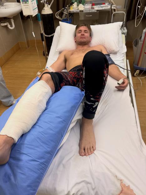 VIDEO: Influencer nearly loses leg in shocking SHARK attack but miraculously survives