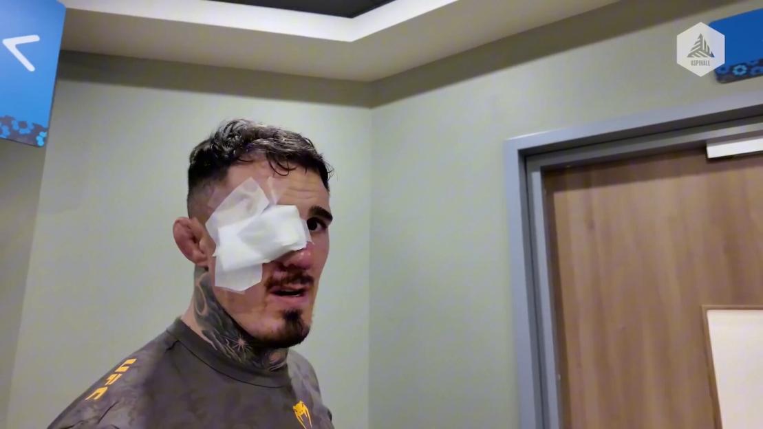 Tom Aspinall with white padding over his right eye after his UFC 321 fight.