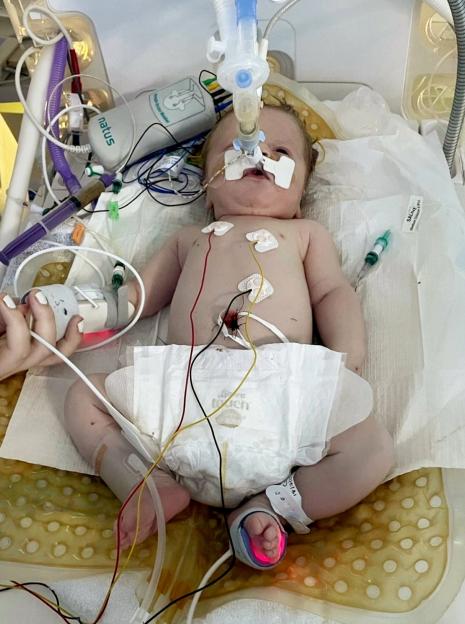 A baby, Cobie Miles, lies in a hospital bed with medical tubes and wires attached to his body, indicating medical negligence after birth.